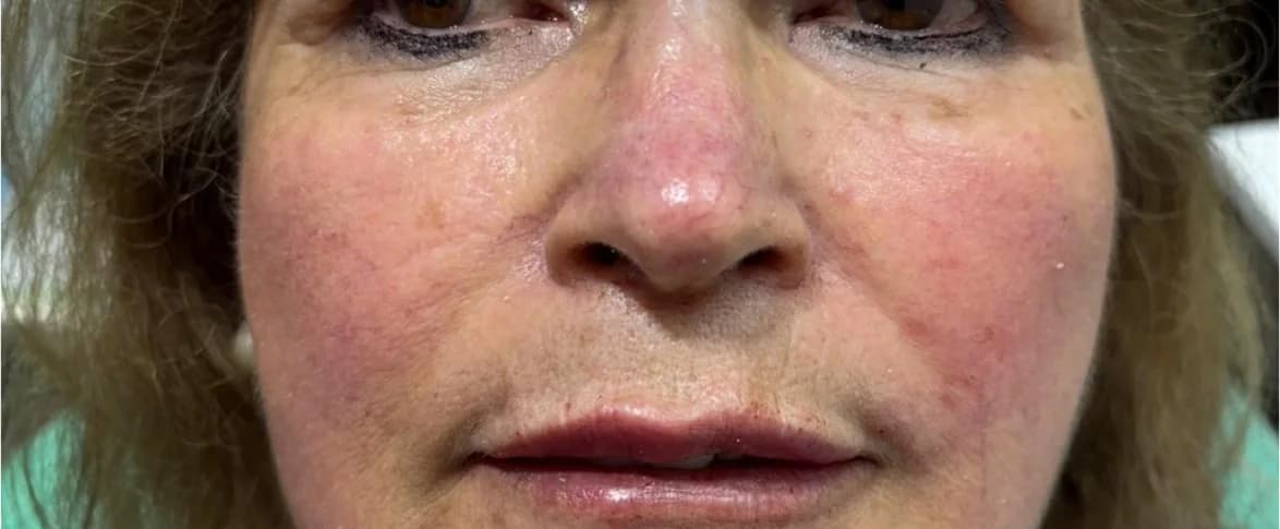 Labios con más definición: después