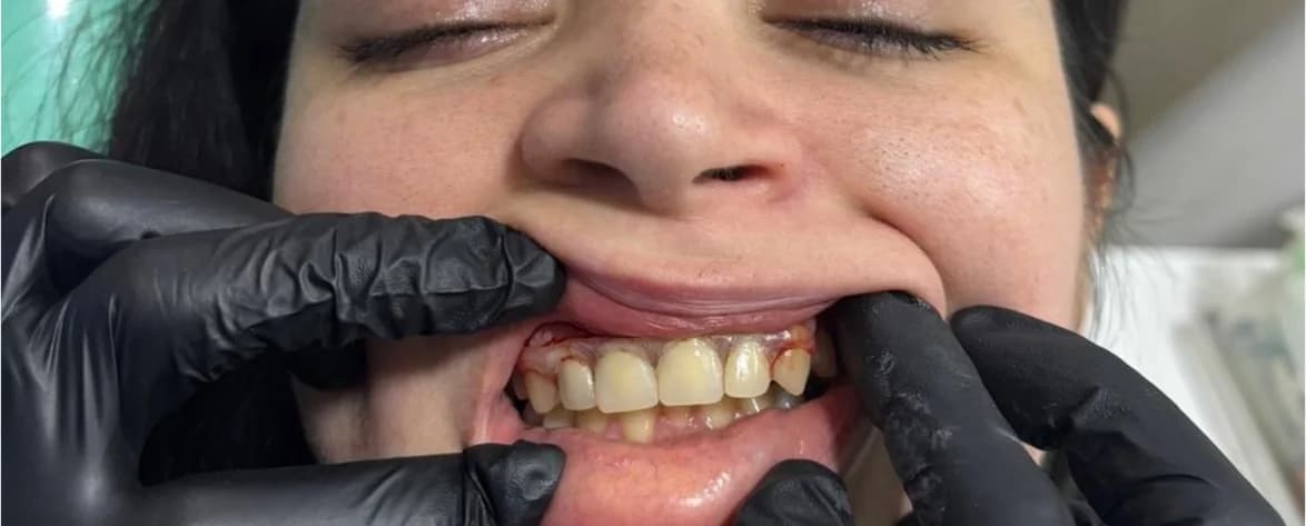 Una sonrisa nueva adelante: después